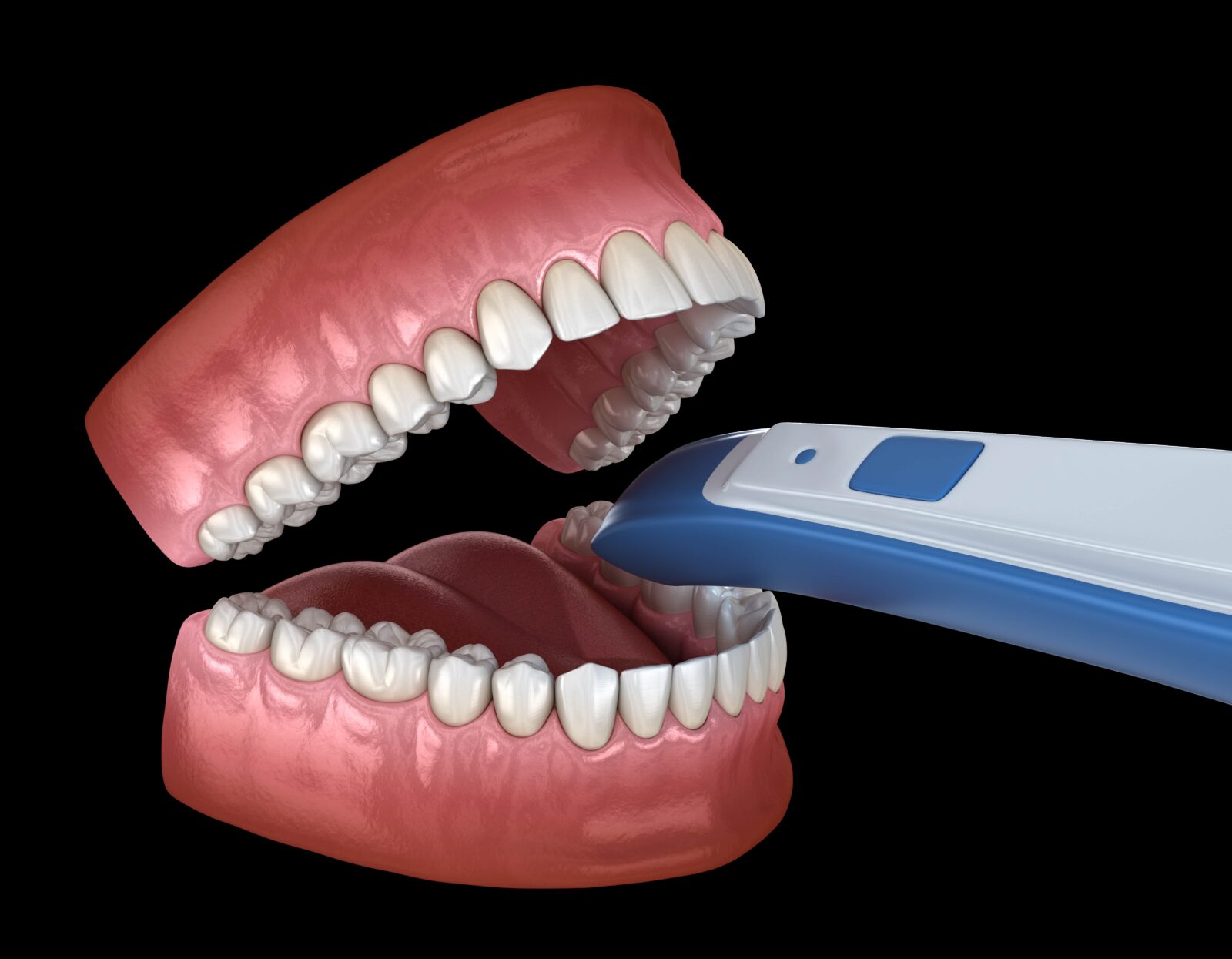 Enhancing Patient Care: The Benefits of Routine Intraoral Scanning for Dental Hygienists Enhancing Patient Care: The Benefits of Routine Intraoral Scanning for Dental Hygienists